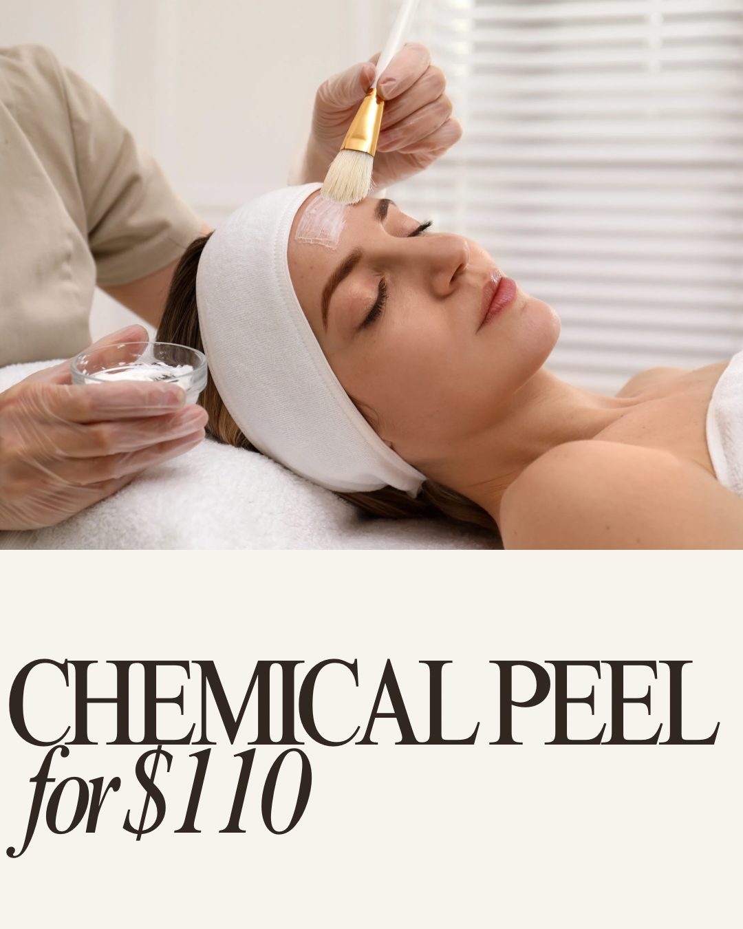 CHEMICAL PEEL